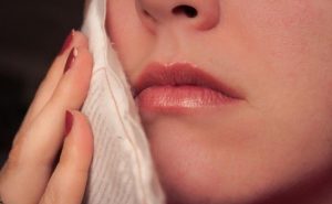 How to Use Warm Compress to Treat Acne